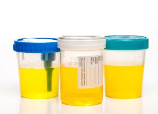 DOT Requires Random Drug Testing Program — Wisconsin Drug Testing Consortium